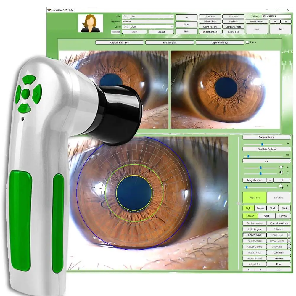 Cámara profesional de iridología ocular, Analizador de Iris HD de 12MP para salones de belleza y clubes de salud