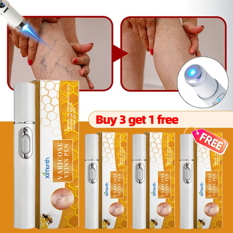 

Лазерная ручка для ремонта ног, устройство для избавления от варикозного расширения вен и улучшения кровообращения, 4 шт.