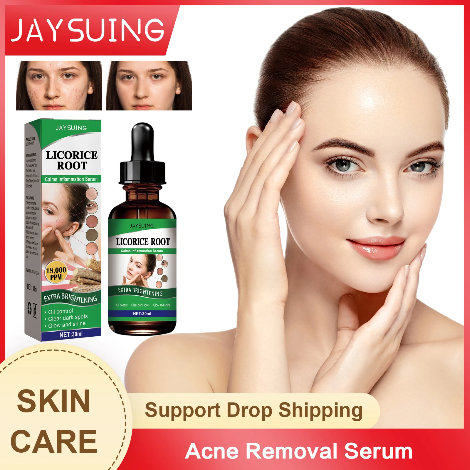 Acne Removal Serum Repair Dark Spots Blackheads Remover Fade Marks Shrink Pores Moisturizing Anti Wrinkle Face Whitening Essence