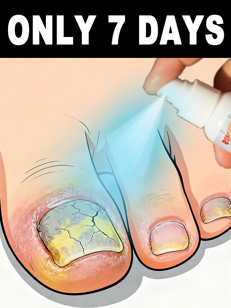 

ᔆᵃʸ ᵍᵒᵒᵈᵇʸᵉ ᵗᵒ ᵒⁿʸᶜʰᵒᵐʸᶜᵒˢⁱˢ!Don't hesitate any longer, start repairing now!