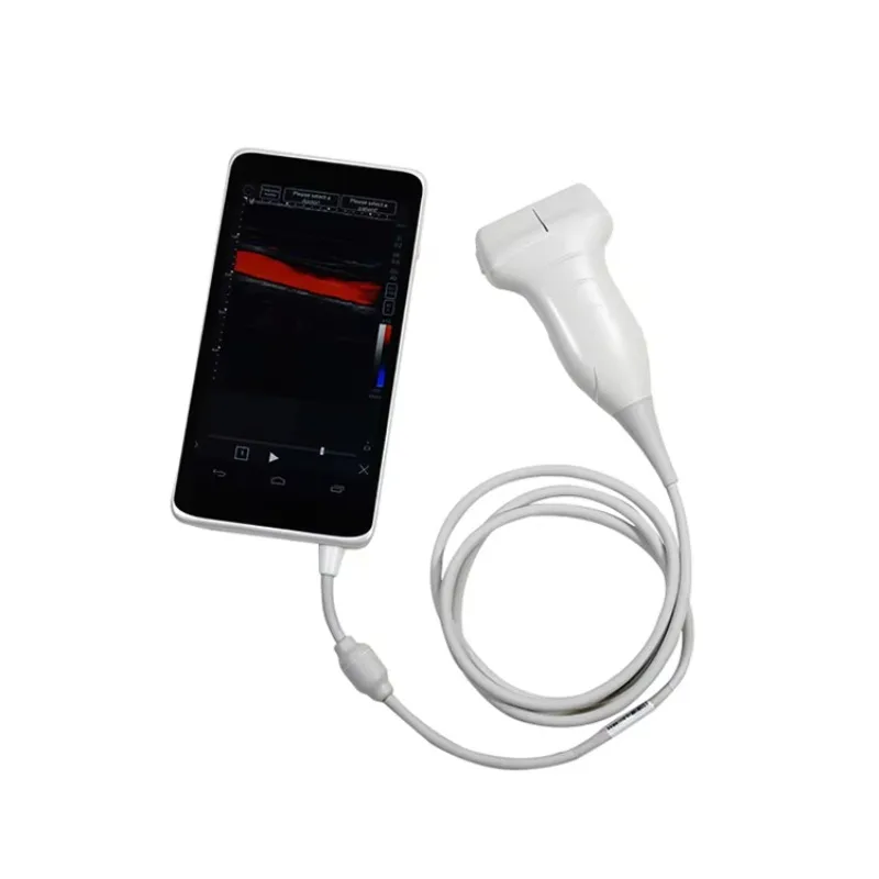 View Handheld Scanner Medical Instruments