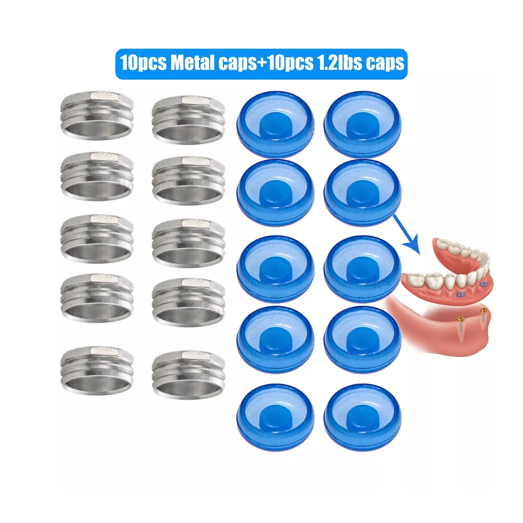 10Pcs Blue Metal Caps 1.2lbs Overdenture Abutment Lab Retention Metal/PEEK