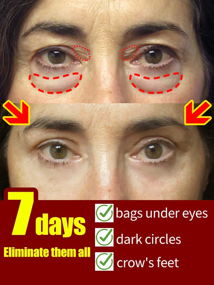 

Repairing problems around the eyes