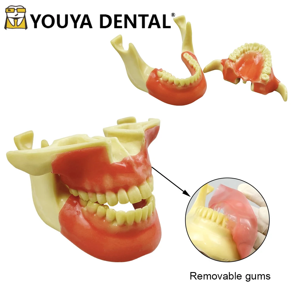 Dental Oral Model Anchorage Nail Exercise Model Foaming Simulated Bone Model Dental implant Practice Teaching Model