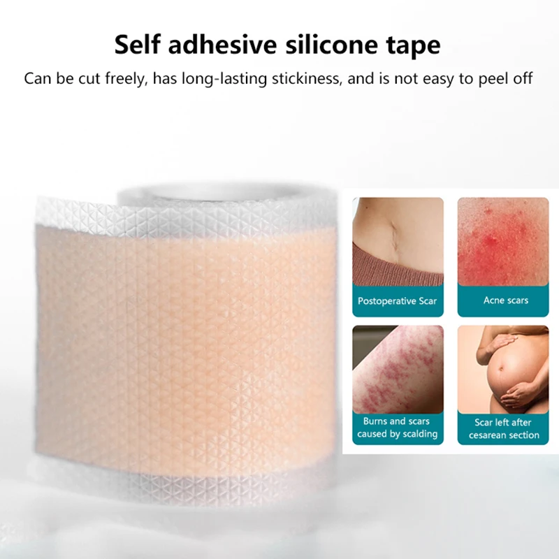 1 Roll Efficient Beauty Self-Adhesive Silicone Gel Tape Removal Scar Tape Help Patch For Acne Trauma Burn Scar Skin Repair