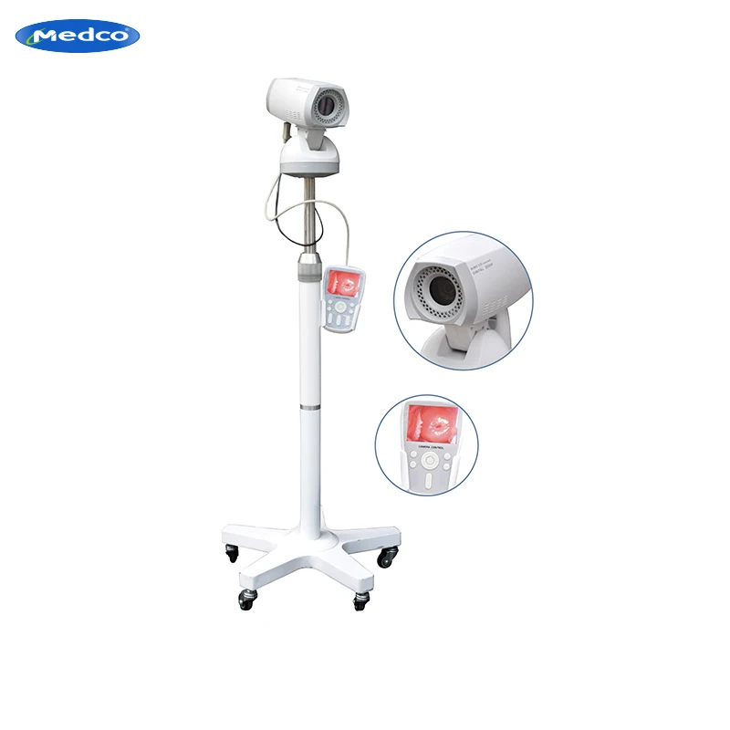 High Accuracy Led Video Colposcope Digital Portable Colposcope With Tripod Hospital Gynecology Inspection Video Colposcope