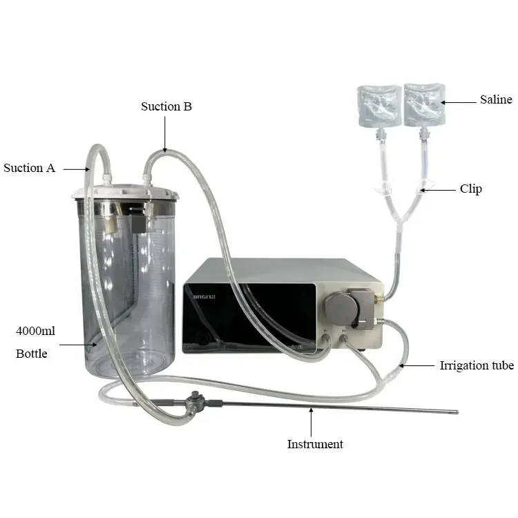 

Новейший гинекологический ирригационный насос/набор гистероскопических насосов/насос для гистероскопии