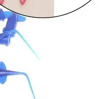 10Pcs Dental Syringe Tips Endo Irrigation Root Canal Butterfly Needle 0.25mm Transparent Blue