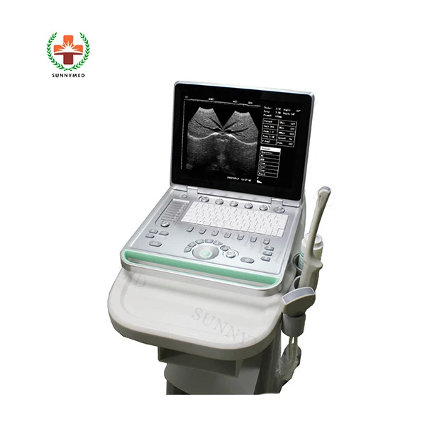 SY-A032 ultrasound scan machine ultrasound machine price ultrasound machine for pregnancy