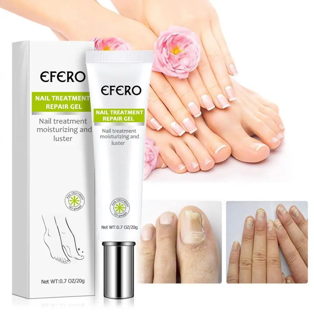 Fungal Nail Treatment Gel Foot Nail Fungus Removal Gel Anti Nails Foot Repair Gel Care Onychomycosis Infection Paronychia Y0M8