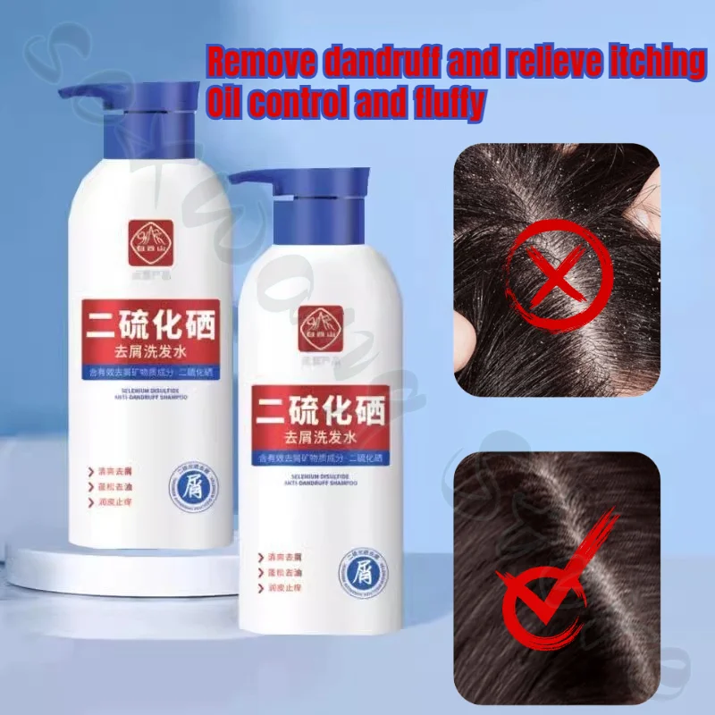 Selenium Disulfide Anti-dandruff Shampoo, Plant Extracts To Improve Scalp Cleansing, Oil Control and Fluffy Shampoo 400ml