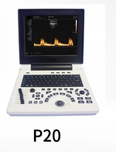 

Portable PC Black and White Super P20 with Abdominal Convex Array Probe