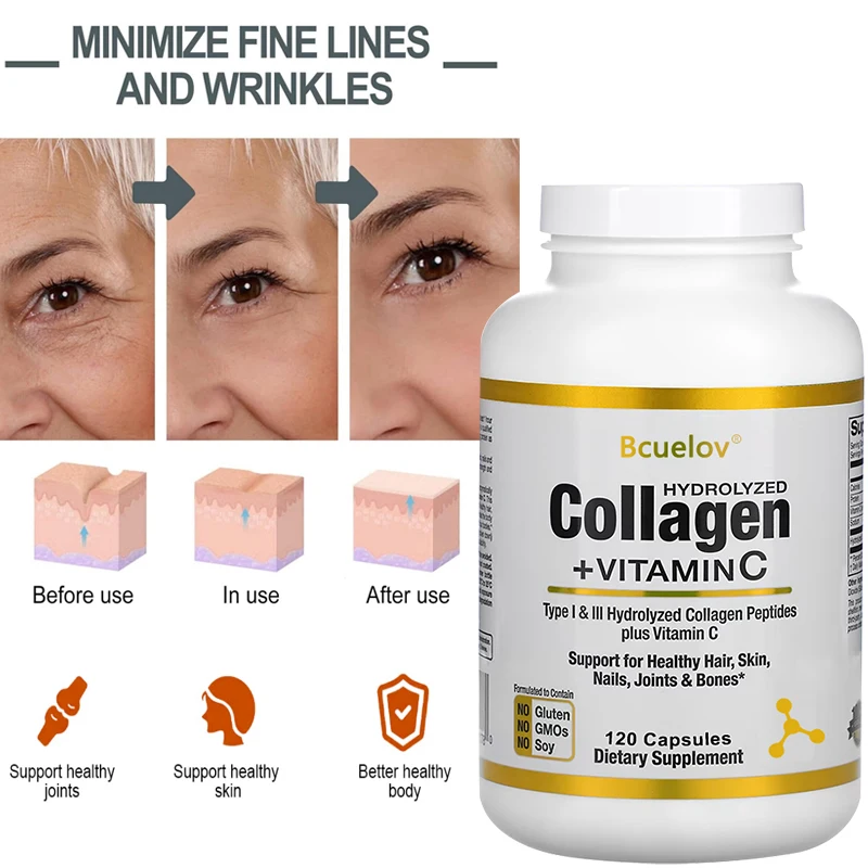 

Hydrolyzed Collagen Peptides + Vitamin C, Types I & III Support Healthy Hair, Skin, Nails, Joints & Bones Boosts Immunity