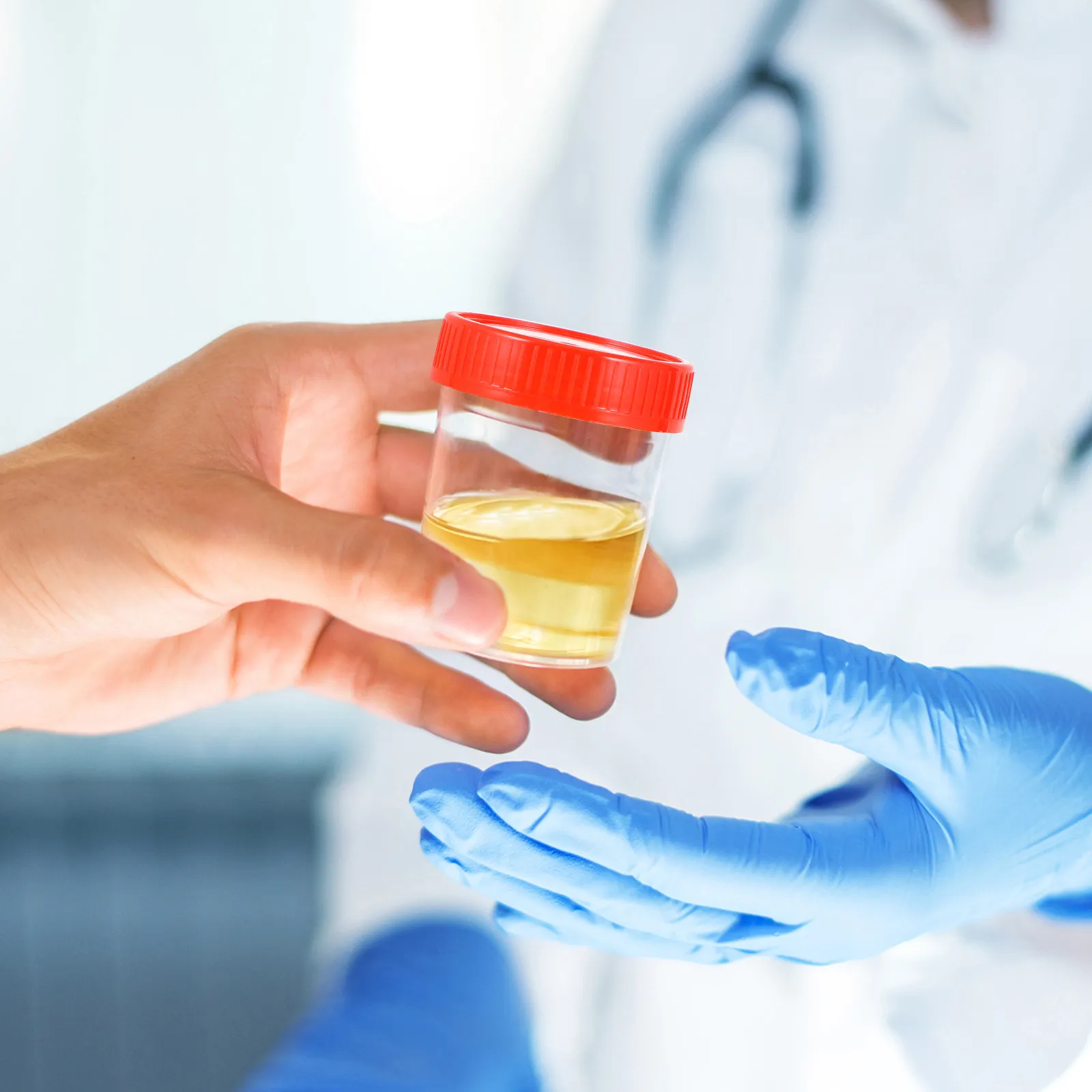 

25Pcs Medical Scale Cup Fecal Specimen Container Leak Proof Protective Lid Disposable Urine Sample Container for Clinic Lab