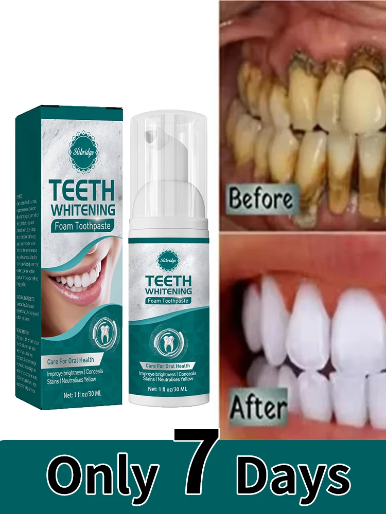 7Days Fast Teeth Whtening Toothpaste Pen Remove Plaque Stain Cleaning Oral Hygiene Bleaching Dental Tool Fresh Breath Tooth Care