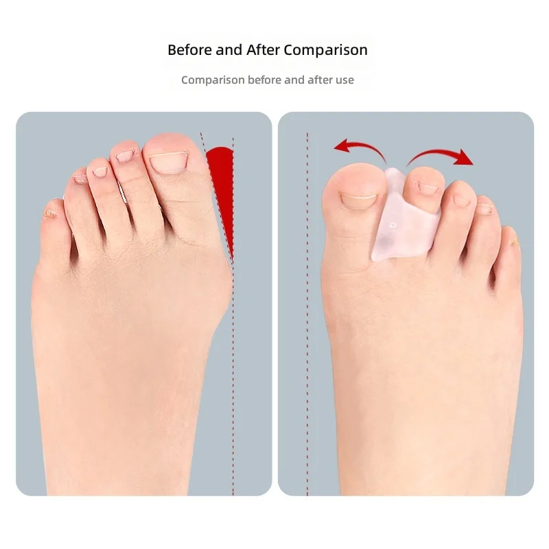 Toe Spacers Toe Separators Hammer Toe Straightener Plantar Bunion Corrector Bunion Splint Feet Care