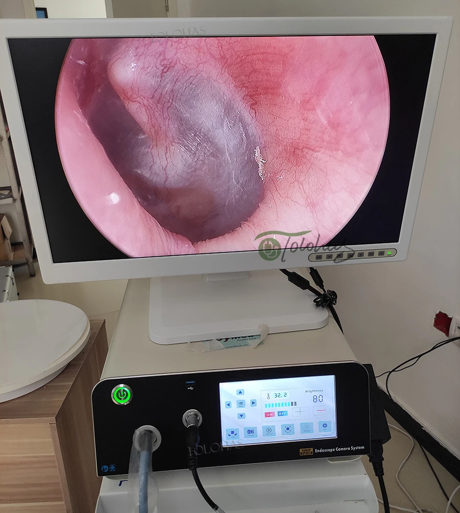 LHPH1000S Photo Collecting Endoscope System  1080P HD Endoscope Camera With 80W LED Light Source