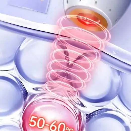 i5 Ultrasonic Cannon lifts your face from the inside out creating a youthful firmer face lifted contours restored elasticity.