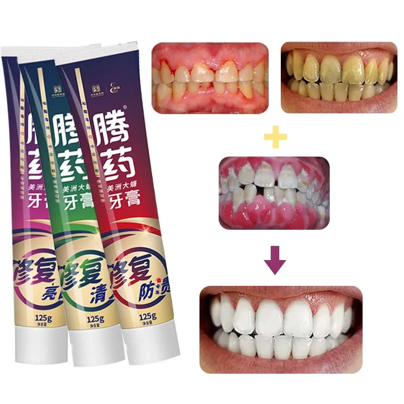 

Removal Plaque Tooth Whitening Strips Toothpaste Fresh Breath Mouth Relieve Gingival Care Bad Breath Oral Clean 펌핑 치약