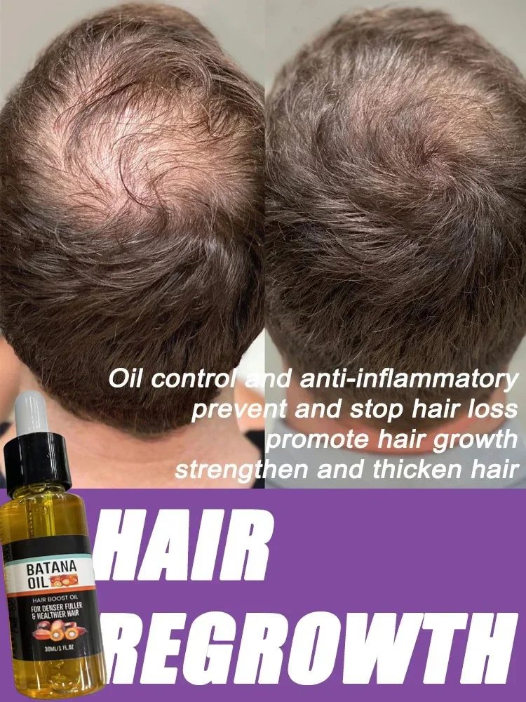 Biotin Hair Growth Serum Rapid Growth Formula Promotes Fuller Thicker Hair