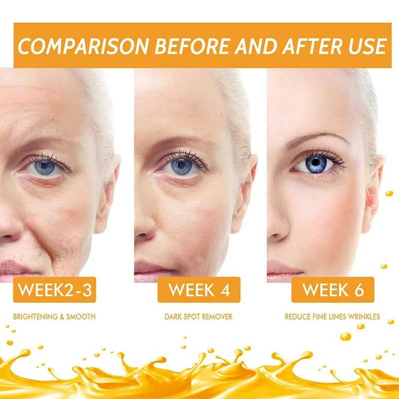 Vitamin C Whitening Serum Remove Dark Spots Freckles Fade Melanin Retinol Anti-wrinkle Essence Brightening Face Beauty Skin Care