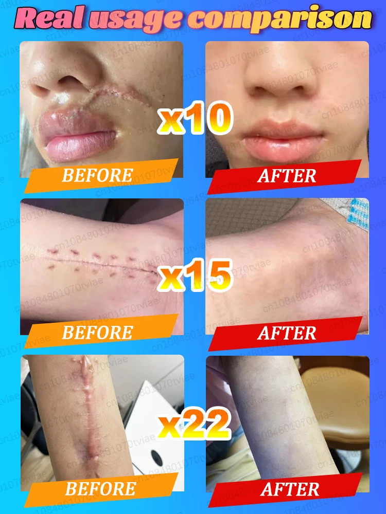 Lassen Sie Ihre Haut frei atmen!