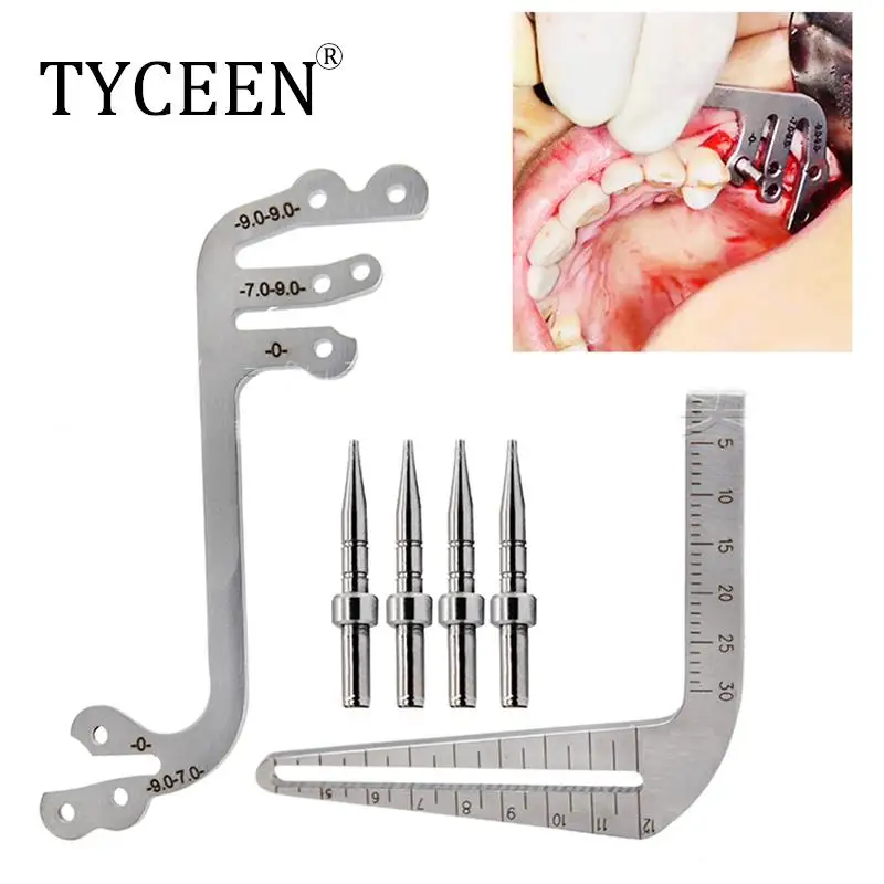 Dental Implant Guide Set Oral Planting Locator Positioning Guide Drilling Positioning Ruler Angle Ruler Implant Tools Dentist