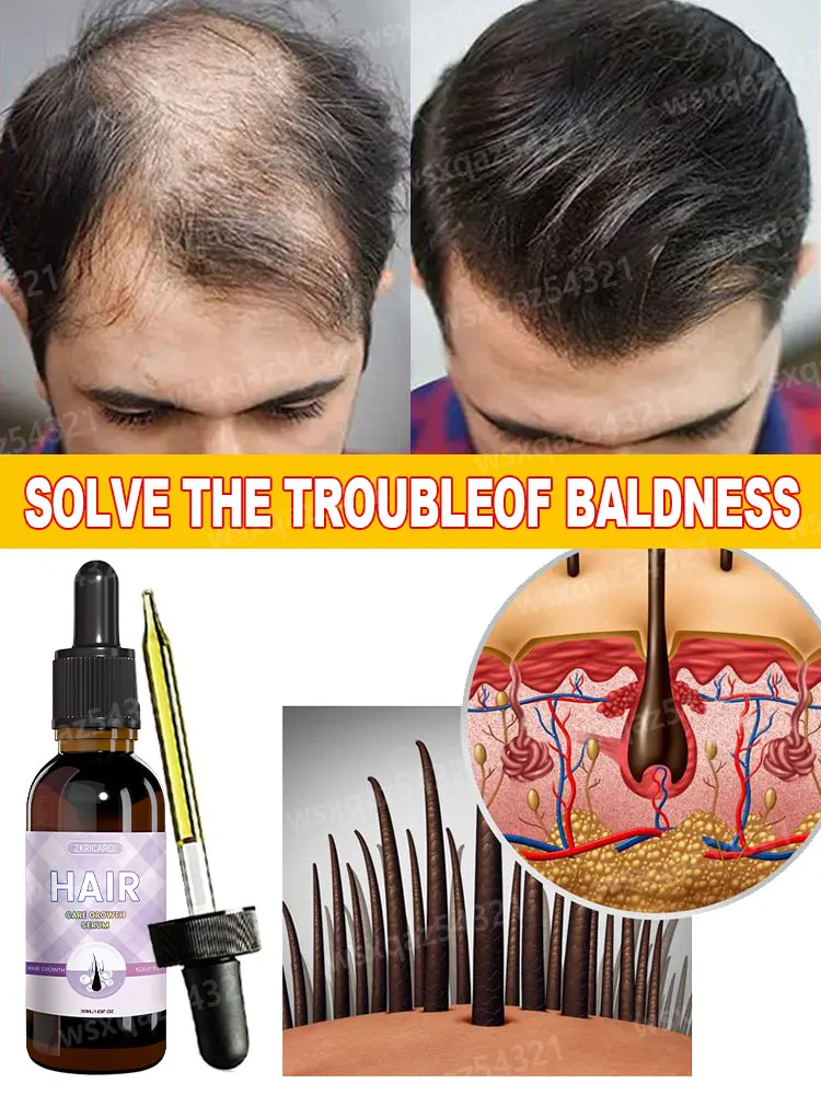 Hot selling product,Rapid hair growth products that can effectively repair baldness and hair loss in 2024