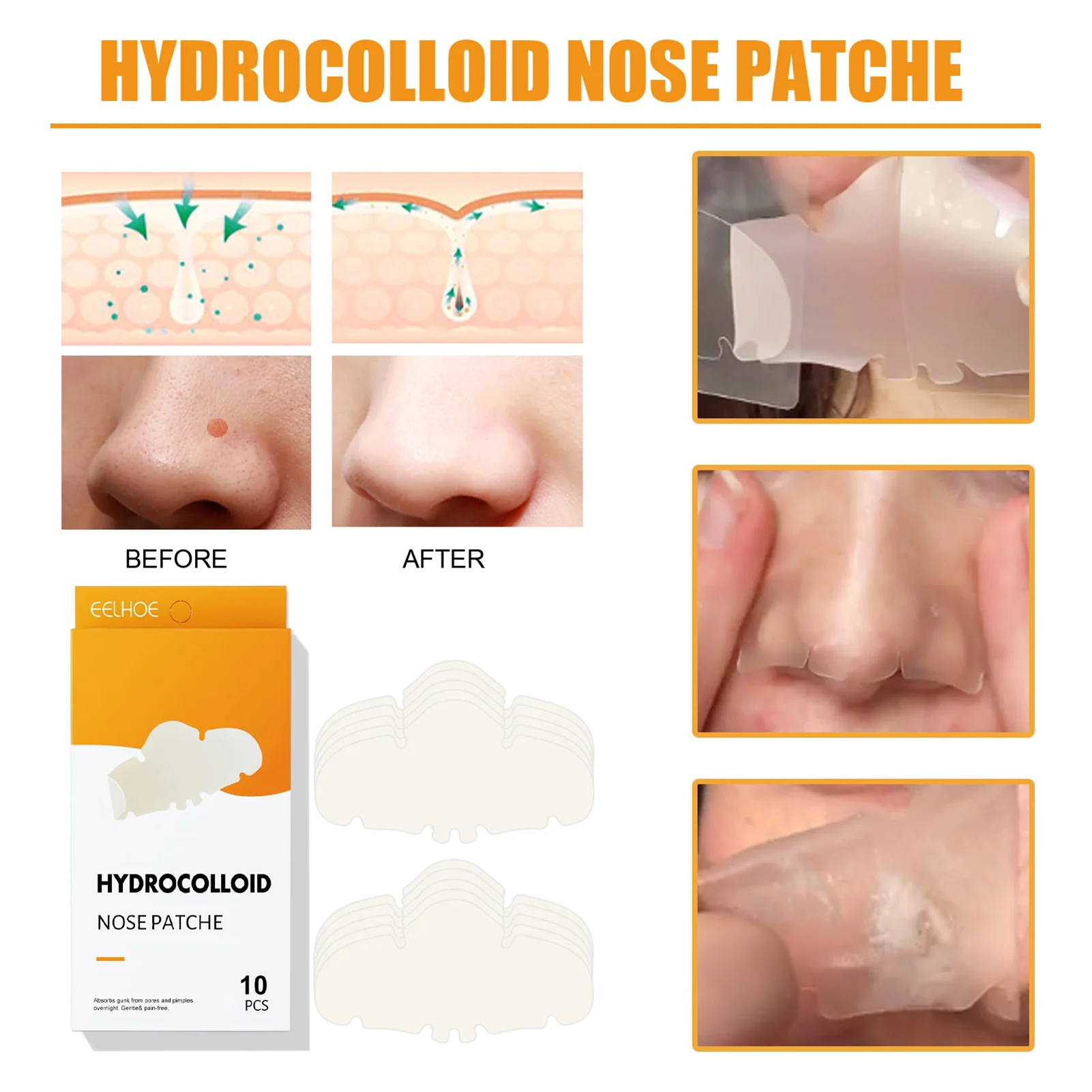 Hydrocolloid Pore Patch Nose Patch Cleans Pores To Remove Blackheads And Ac-ne Patches For Nose Pores Pimples Zits And Oil