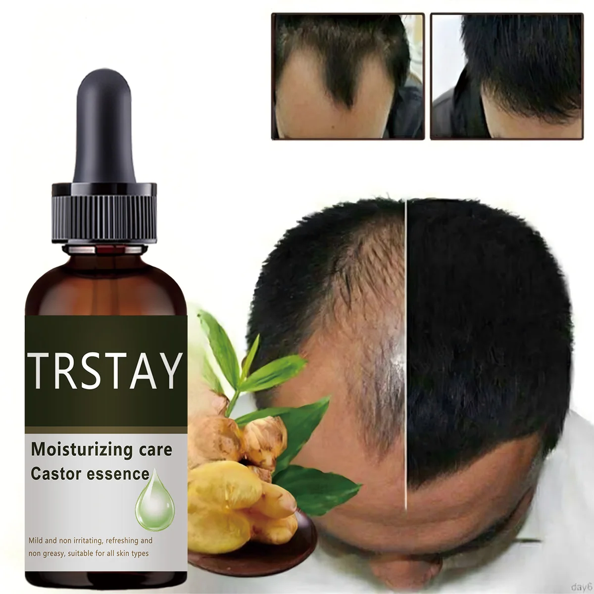 

Эфирное масло для быстрого роста волос, эффективное лечение выпадения волос, имбирная сыворотка для восстановления роста, уход за волосами, красота