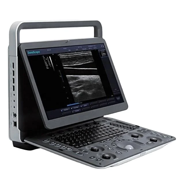 Medical Ultrasound Instruments Sonoscape E1 E2 E3 PW Color doppler portable B/W Ultrasound machine with Trolley