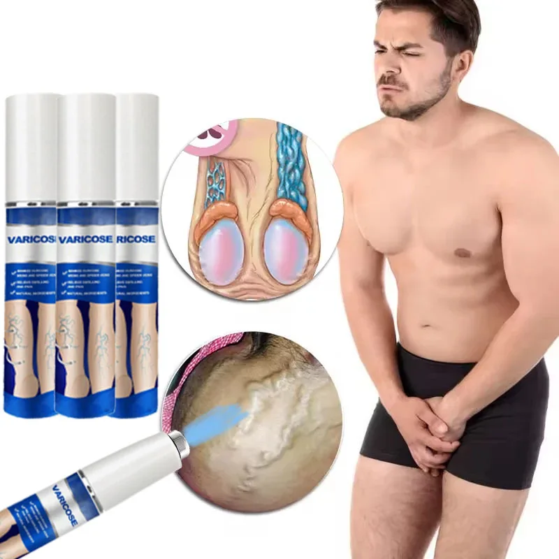 الجيل الثالث يزيل التهاب الأوعية الدموية والتهاب الوريد ويخفف آلام الساق العنكبوتية ومؤشر العلاج بالليزر للدوالي