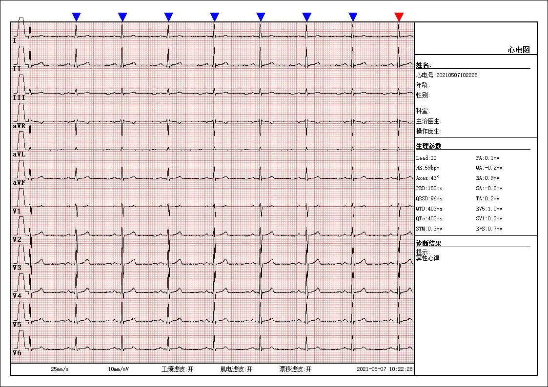 12 Leads 3 Channels Normal Dog Canine Cat Pet  Electrocardiogram for Dogs