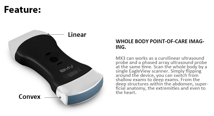 Factory direct sale Handheld  WIFI USB Ultrasound Android Phased Array Cardiac Linear Convex 3 In 1  Wireless Ultrasound Probe