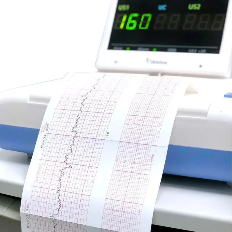 Electrocardiograph Printer Paper Thermal ECG Paper Clear Accurate Grid High Sensitivity For Hospital  Use 50/63/80/110mm
