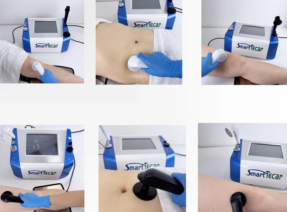 Factory Physical Smart Tecar Diatermia Tecartherapy Tecarterapia Cet Ret Diathermy Terapia Pain Relief Physio Therapy Machine