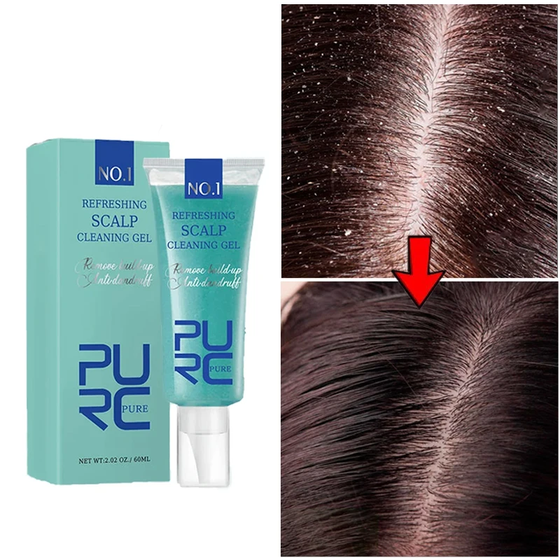 

PURC Hair Treatments Anti Dandruff Gel Exfoliating Straightening Hair Oil Control Anti-itch Smoothing Shiny Hair Care 60ml