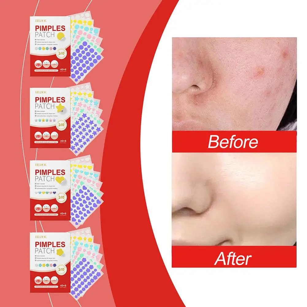 Colorido e bonito estrela-como a remoção do acne, ferramenta do cuidado da pele, cuidados faciais, beleza, t9w0