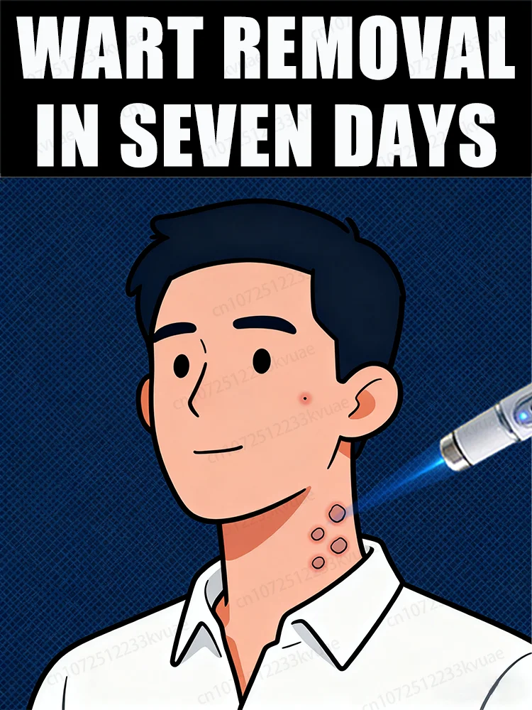 Penna a luce blu di vendita calda per risolvere le verruche del corpo, strumenti per la cura delle verruche