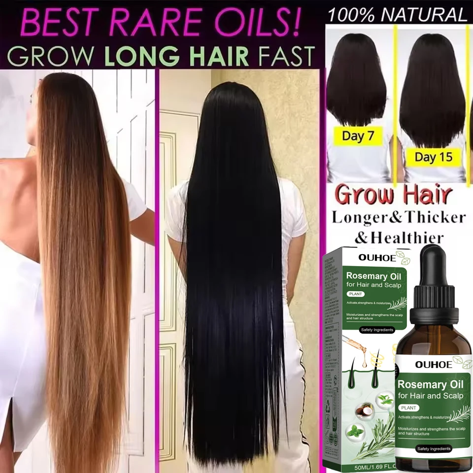 

Продукты для роста волос с розмарином, предотвращающие выпадение волос, эфирное масло, быстрорастущее средство против высыхания кожи головы, красота, здоровье, мужчины, женщины