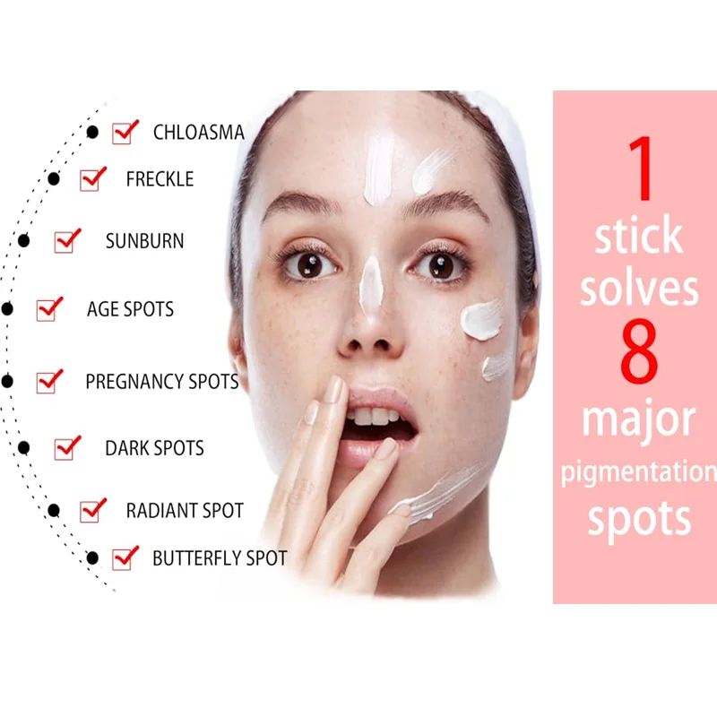 Removal Dark Spots Whitening Freckle Cream Leaving Skin Looking Brighter Clearer and More Luminous Prevent Future Discoloration