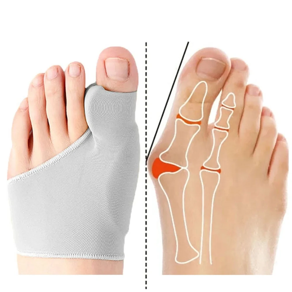 2pcs=1pair Men\'s Socks Gray Toe Hallux Valgus Bunion Corrector Orthotics Feet Bone Thumb Adjuster Pedicure Correction Sock