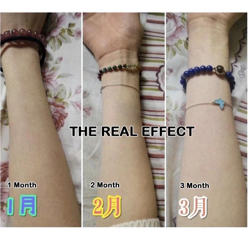 140g ciemny czarny rozjaśnianie skóry mydło kwas mydło wybielające kwas gliceryna rozjaśnić twarzy ciała skóry wybielanie mydło TZ11C12