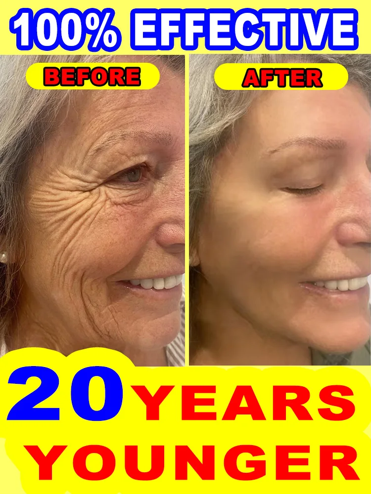 

20 years younger, no fine lines