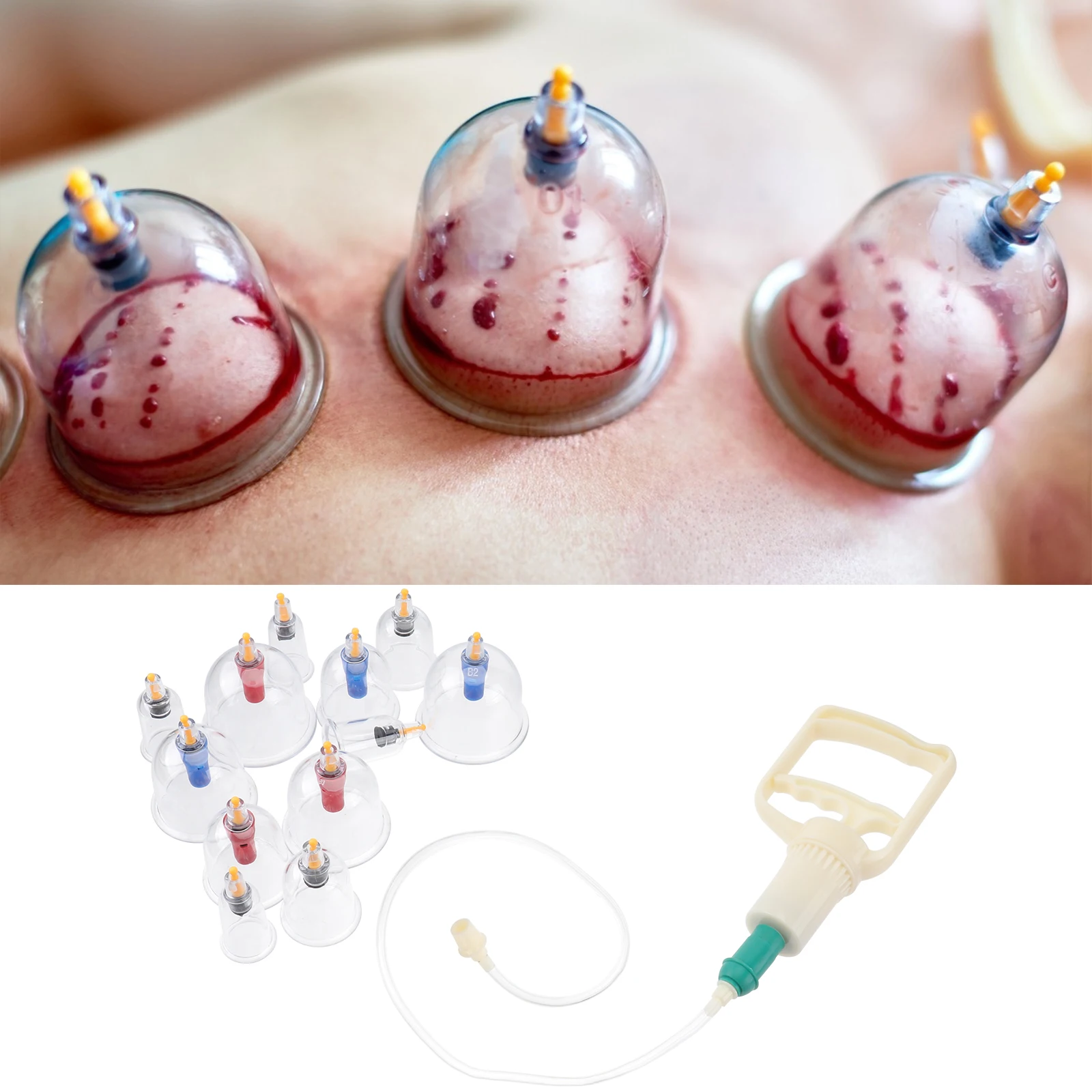 

1 комплект, вакуумный аппарат для банок, прочный китайский набор для баночной терапии, устройство для массажа тела, облегчение мышечной боли, физиотерапия