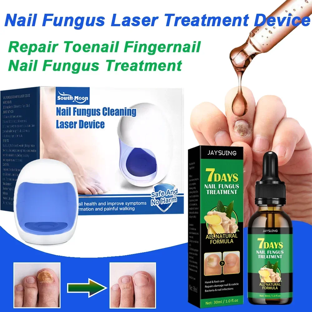 

Nail Fungus Laser Treatment Device Fingernail Fungus Treat Onychomycosis Therapy Effectively Remove Onychomycosis Grow Toe Nail