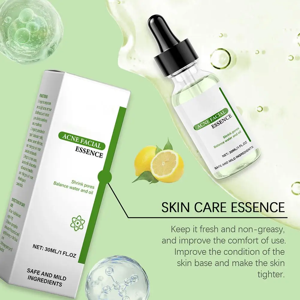 30 мл эффективная жидкость для удаления прыщей, удобная жидкость для удаления прыщей, улучшение прыщей, удобный раствор для восстановления лица, средства по уходу за кожей