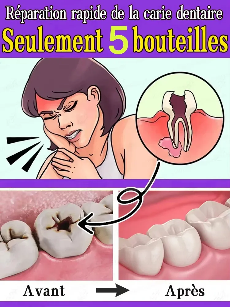 Contains Probiotics to Repair Tooth Decay and Clean Teeth