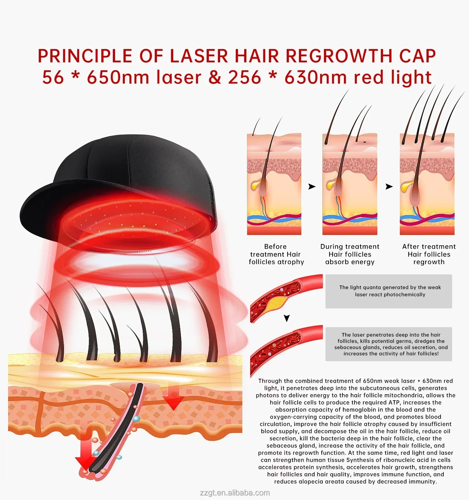 650nm Red Light Therapy Hair Cap by COZING, LLLT Laser Helmet for Effective Hair Regrowth Treatment