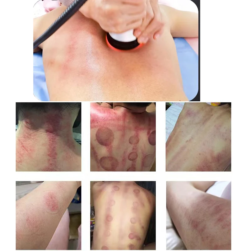 أداة العناية بالجسم بالموجات فوق الصوتية 4 في 1 40 كيلو جديدة